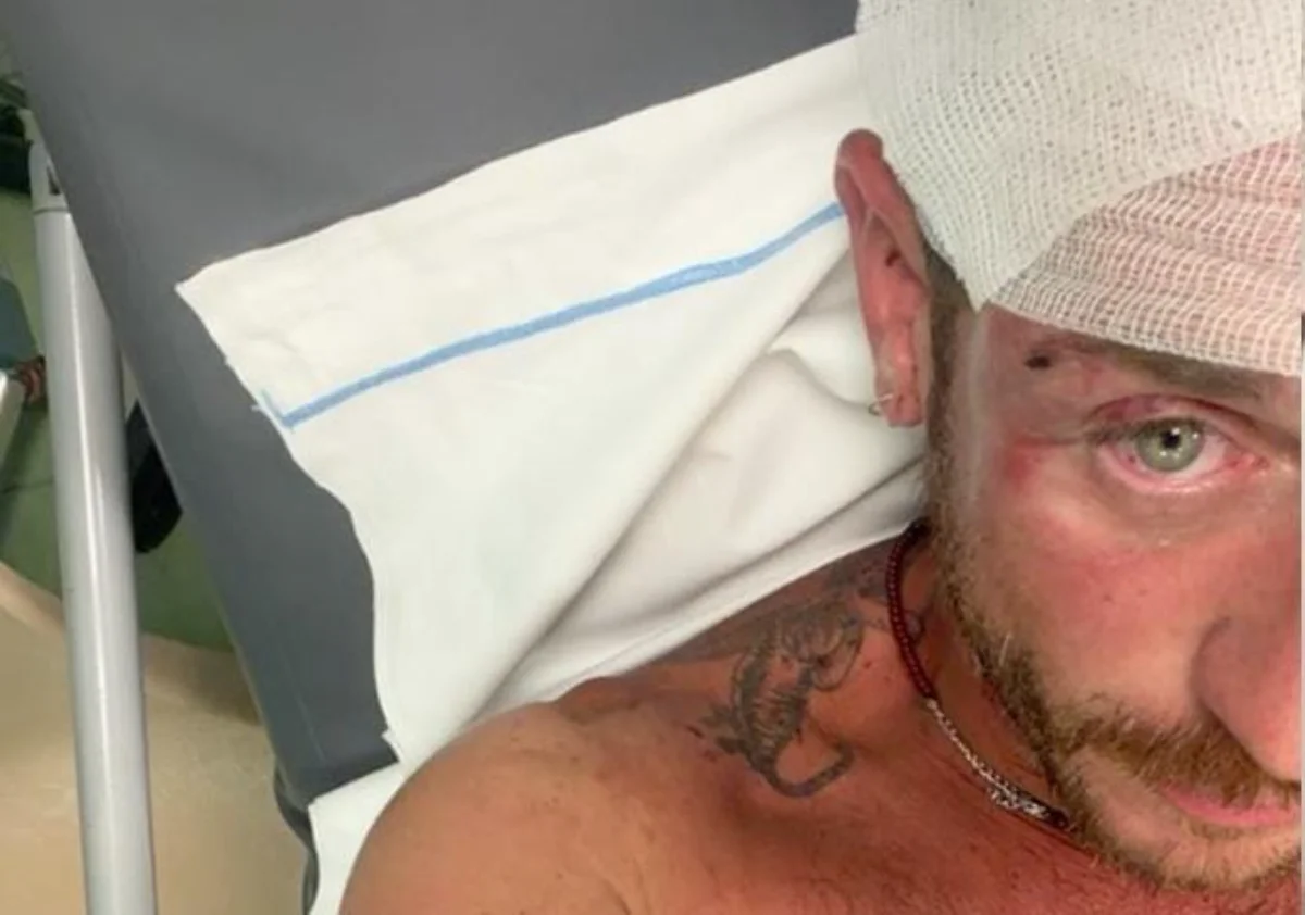 Violenza omofoba a Porto Istana: pestato a sangue e «insultato anche dai soccorritori»